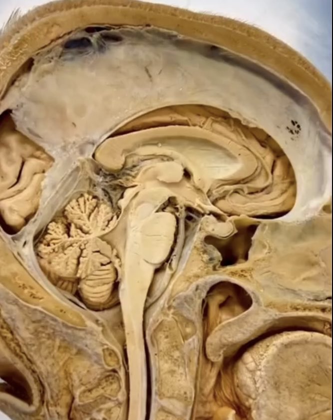 OGdukeneurosurg's tweet image. Warning ⚠️ Magnificent look at Midline Neuro Anatomy from Abhiieet Satani. Which structure did you see first?