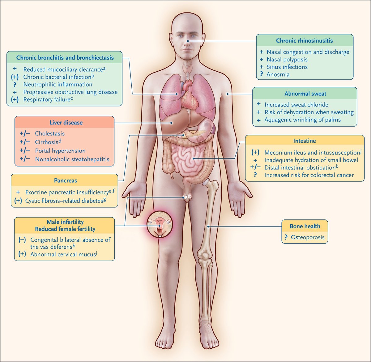 Sovetorax Tips tweet media
