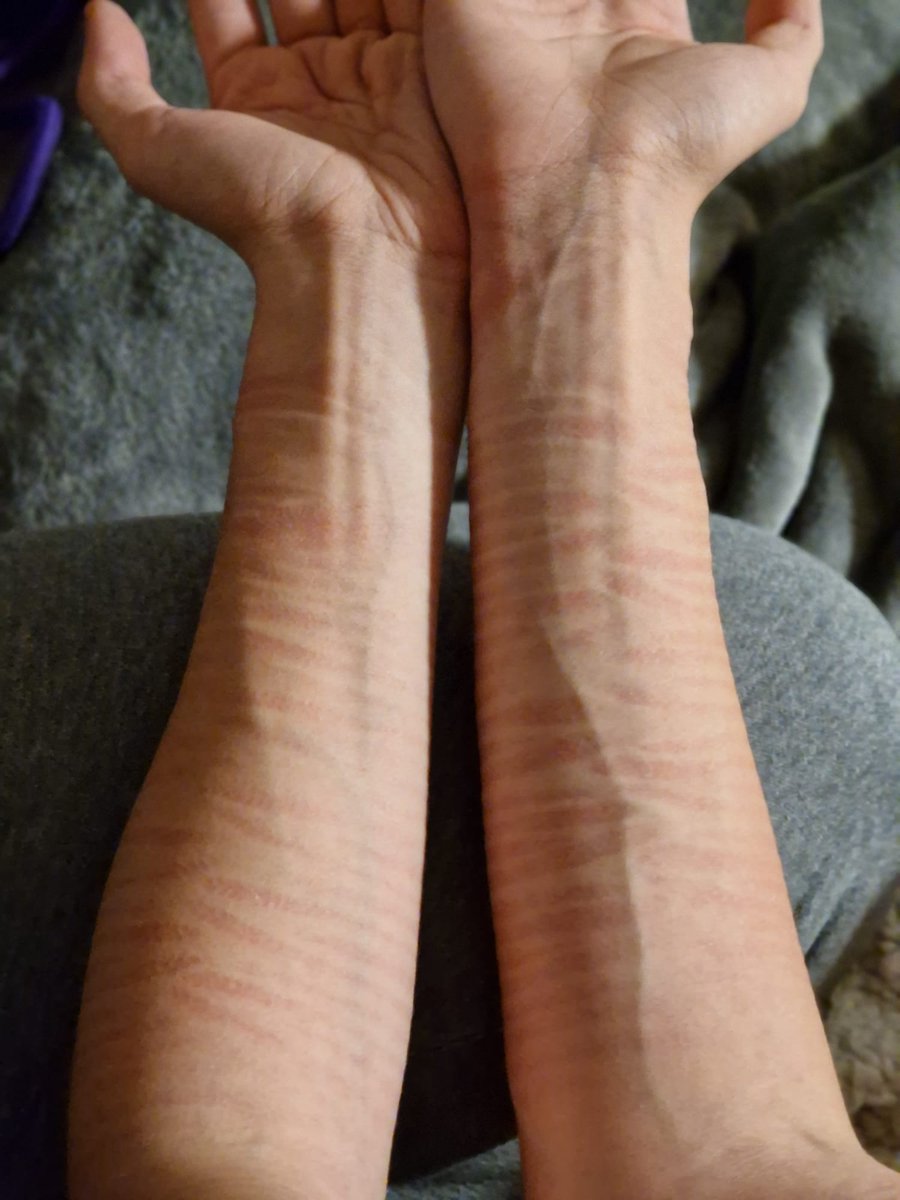 After shibari session be like⛓️:
#shibari #gay #gaytwink #twink #bondage #rope #ropes #ropebunny #german #kink