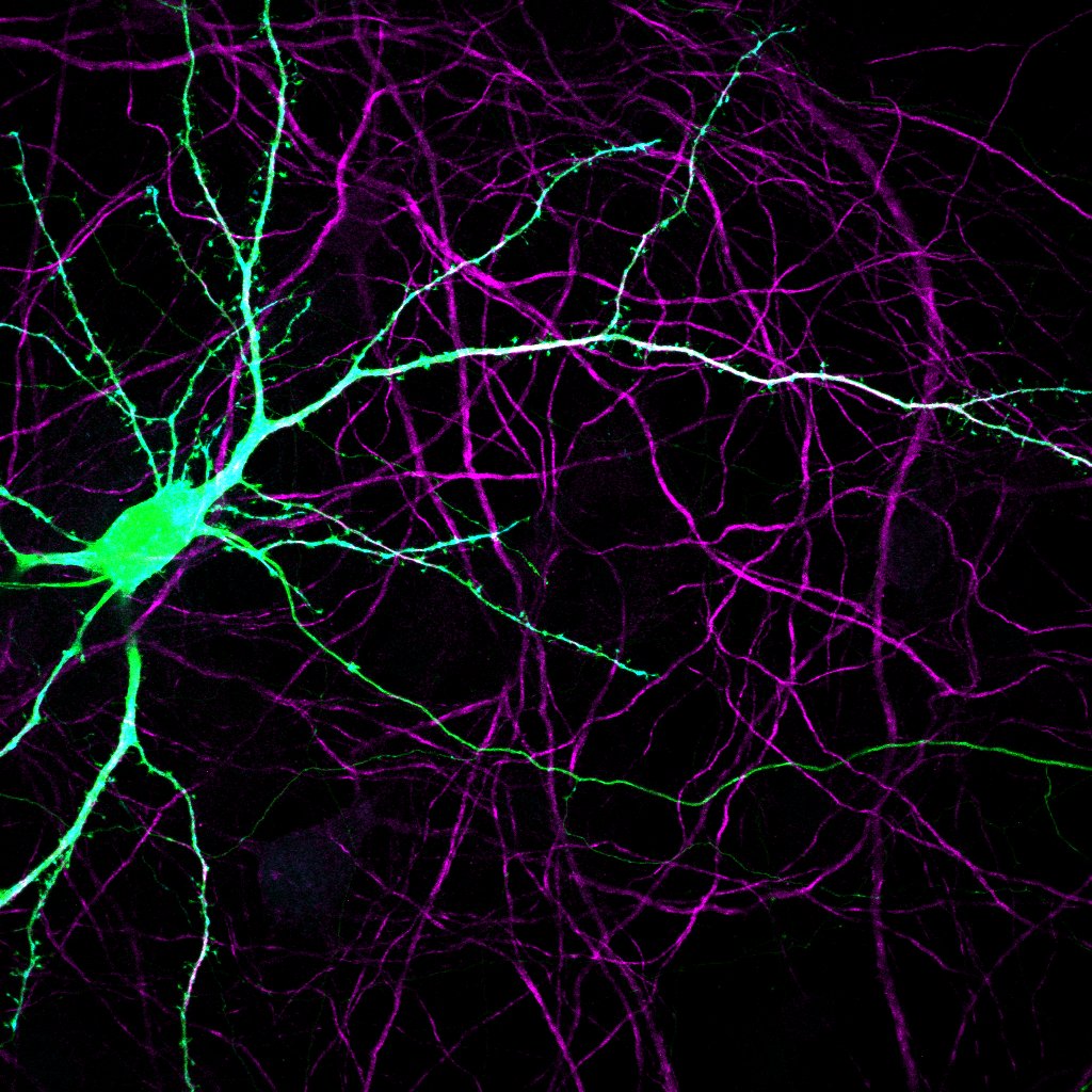 Kevin H Chen (@khc_jhmi) on Twitter photo Excited to share my work from <a href="/ZhaozhuQ/">Zhaozhu Qiu</a> Lab at #SfN2023! If you are interested in ion channels, synaptic plasticity, and endosome biology check out my poster D19 on November 15 8AM-12PM! Excited to share my work from <a href="/ZhaozhuQ/">Zhaozhu Qiu</a> Lab at #SfN2023! If you are interested in ion channels, synaptic plasticity, and endosome biology check out my poster D19 on November 15 8AM-12PM!