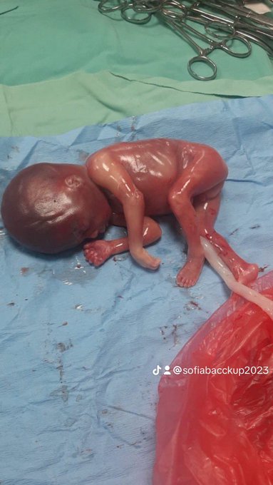 @POTUS this must turn you Zionists pieces of shit on huh? The mother to this 5 month old fetus ! Was<a class="tags" target="_blank" title="On Twitter" href="/?out=eyJ0eXAiOiJKV1QiLCJhbGciOiJIUzUxMiJ9.eyJpYXQiOjE3MjQ3NTcwODQsImlzcyI6InR3cG9ybnN0YXJzLmNvbSIsIm5iZiI6MTcyNDc1NzA4NCwiZXhwIjoxNzU2MjkzMDg0LCJyZWRpcmVjdF91cmwiOiJodHRwczovL3R3aXR0ZXIuY29tL1BPVFVTIn0.hOlFQvvxot0Zcgn5TB_MAL0nFcYCRaL0tvta8Lw5q82dVX-XHP1ppitaGuwCPauX99FLpIONrozfvHjqqa7-dg">@POTUS</a><a href="/tag/toronto"class="tags"><span>#toronto</span></a><a href="/tag/palestine"class="tags"><span>#palestine</span></a><a href="/tag/indigenoussolidarity"class="tags"><span>#indigenoussolidarity</span></a>