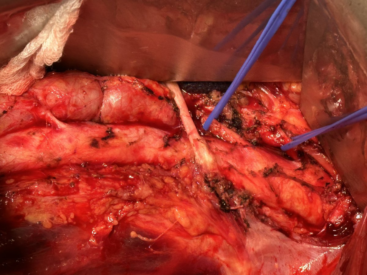 Jeromy Brink, MD tweet media