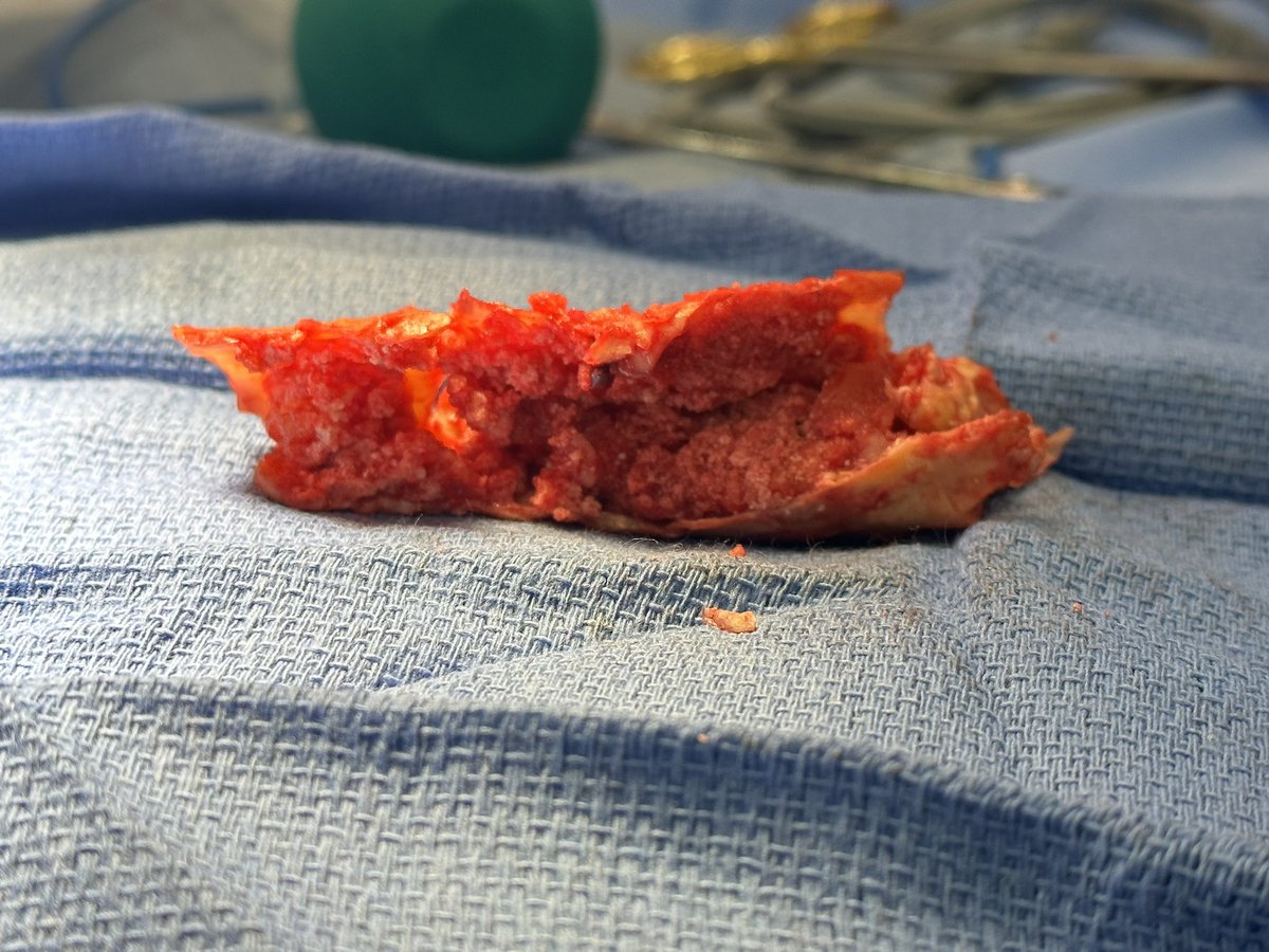 Jeromy Brink, MD tweet media