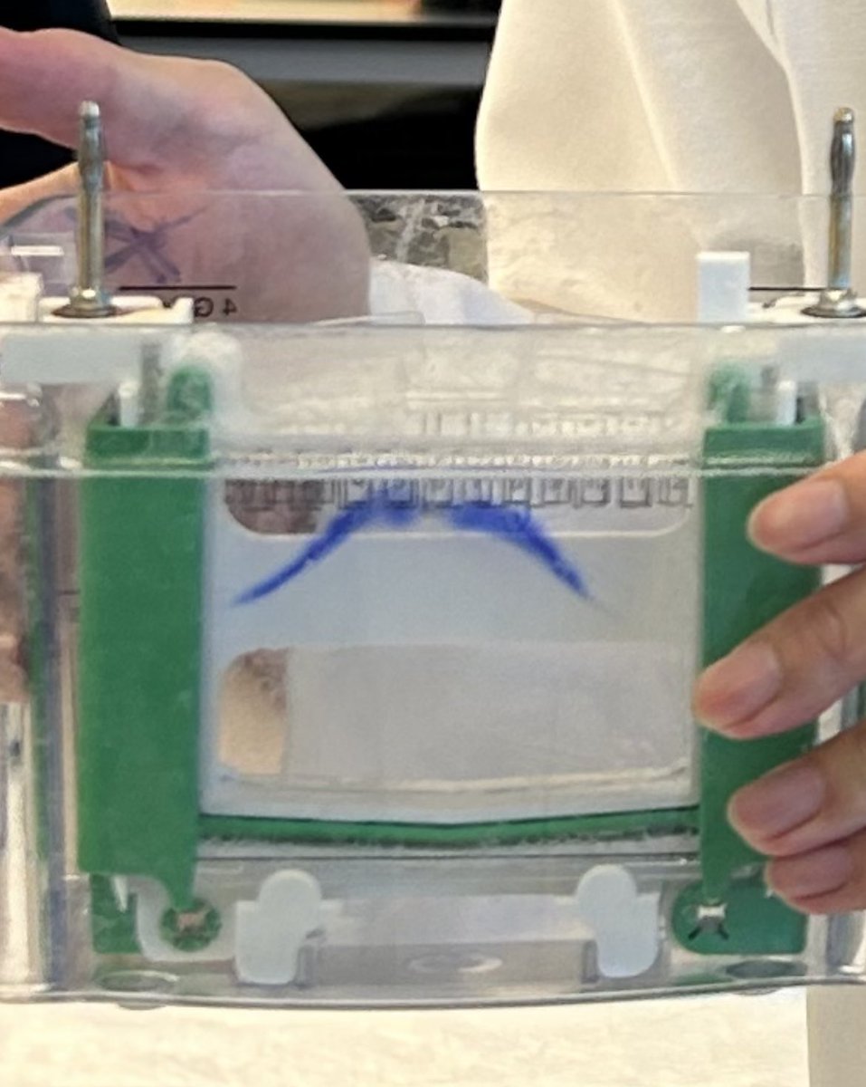RyanDenu's tweet photo. I call this the mustache blot. #science #labfail https://t.co/HbkKMDWeg6