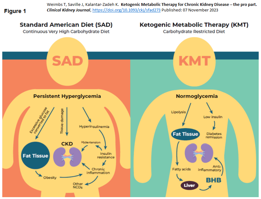 kamkalantar's tweet photo. Ketogenic Metabolic Therapy #KMT for CKD
PLAnt-DOminant #PLADO versions of KMT expand kidney health toolbox will likely become a first-line Rx in certain CKD conditions such as obesity, metabolic syndrome & polycystic kidney disease #PKD
https://t.co/prfRnzzIIz @weimbslab https://t.co/ZjmnFXpMaD