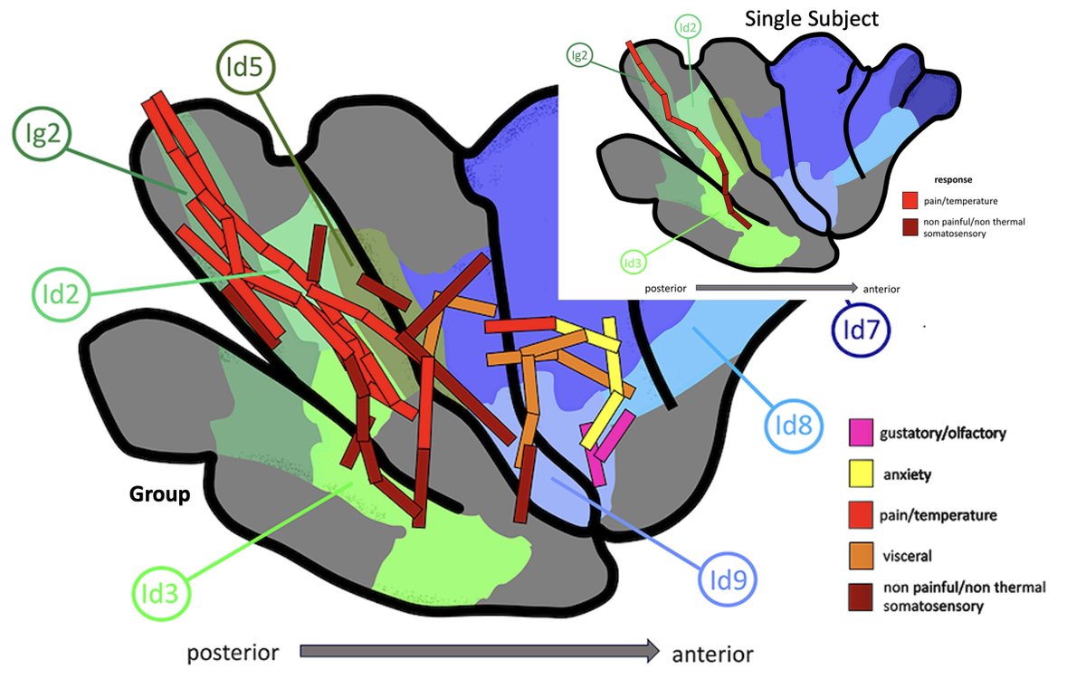 Josef Parvizi (@josef_parvizi) on Twitter photo Your insula when electrically stimulated: Changes in the subjective states elicited with stimulation match the cytoarchitectural organization of the insula. Collaborative work with neurosurgeon <a href="/VivekBuchMD/">Vivek P. Buch, MD</a> and Svenja Caspers <a href="/LabCaspers/">Svenja Caspers</a>. DOI: 10.1016/j.brs.2023.11.001 Your insula when electrically stimulated: Changes in the subjective states elicited with stimulation match the cytoarchitectural organization of the insula. Collaborative work with neurosurgeon <a href="/VivekBuchMD/">Vivek P. Buch, MD</a> and Svenja Caspers <a href="/LabCaspers/">Svenja Caspers</a>. DOI: 10.1016/j.brs.2023.11.001