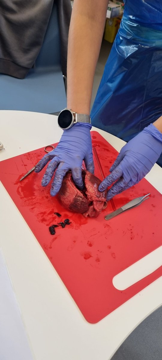 Dr Simon Fryer πΊπ¦ (@drsifryer) on Twitter photo What better way for <a href="/uniofglos/">University of Gloucestershire</a> Sport & Exercise, Sports Therapy and Strength & Conditioning students to learn about the heart than a dissection #Physiology #heart What better way for <a href="/uniofglos/">University of Gloucestershire</a> Sport & Exercise, Sports Therapy and Strength & Conditioning students to learn about the heart than a dissection #Physiology #heart