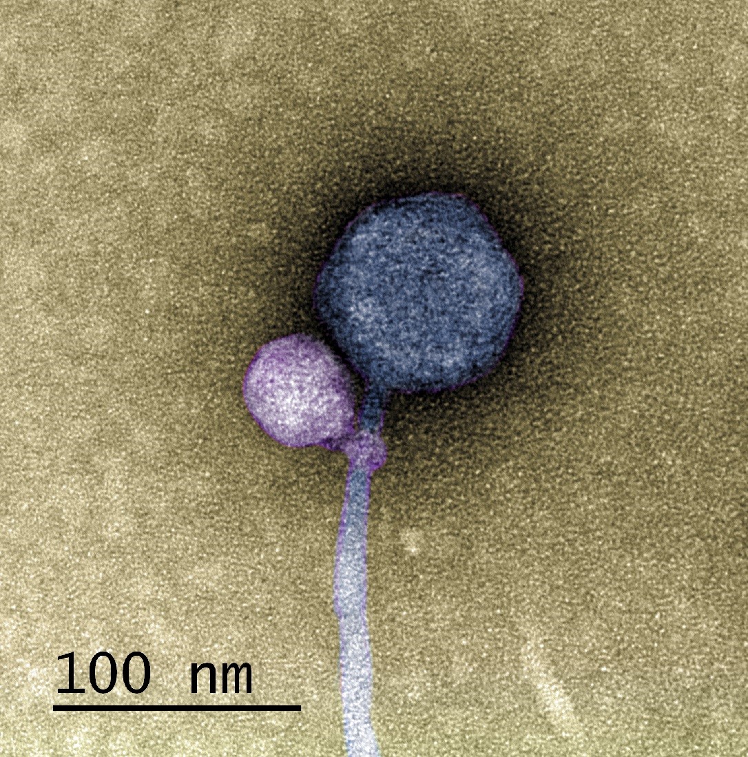 This is the first known observation of a virus   attaching to another virus – talk about exciting!

In this picture, a satellite bacteriophage consistently attached to a helper phage at the neck.

Take a look at the amazing pictures 🔗rb.gy/fo8n8r