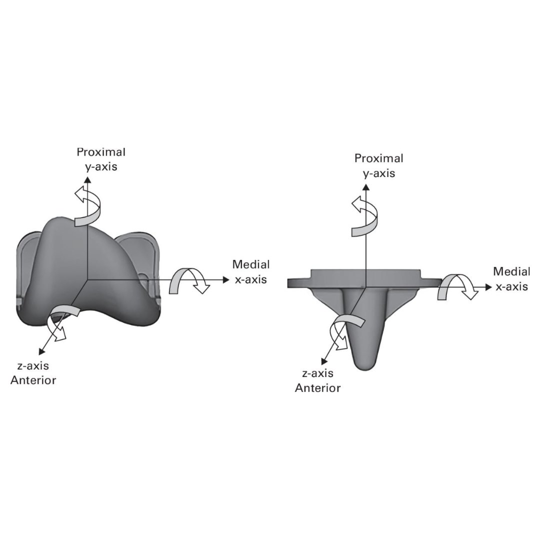 This RCT evaluated five-year follow-up results comparing cemented ATTUNE and PFC-Sigma cruciate retaining TKAs, analyzing component migration, clinical outcomes, PROMs, and radiological outcomes.

#KneeReplacement #RCT #OrthoTwitter #BJJ

ow.ly/iHkL50Q3wJ5