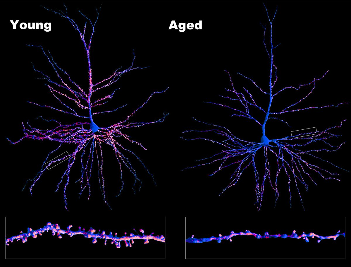 Danielle Beckman (@danibeckman) on Twitter photo What's the biggest difference between a neuron from a young vs. an aged primate? It is not the length of the axon and dendrites, but the number of spines available to make contact and connections with other surrounding neurons! 3D recon. made with <a href="/ImarisSoftware/">Imaris 3D/4D Imaging</a> #neuroscience What's the biggest difference between a neuron from a young vs. an aged primate? It is not the length of the axon and dendrites, but the number of spines available to make contact and connections with other surrounding neurons! 3D recon. made with <a href="/ImarisSoftware/">Imaris 3D/4D Imaging</a> #neuroscience