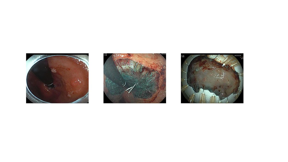Brisbane Endoscopy tweet media