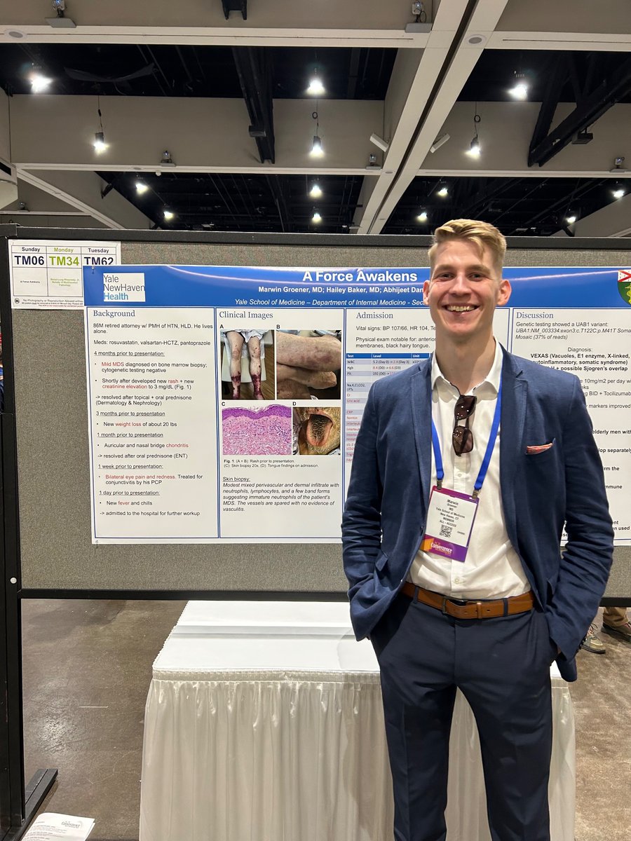 Thanks to everyone who stopped by my poster today #ACR23.
Looking forward to Day 2