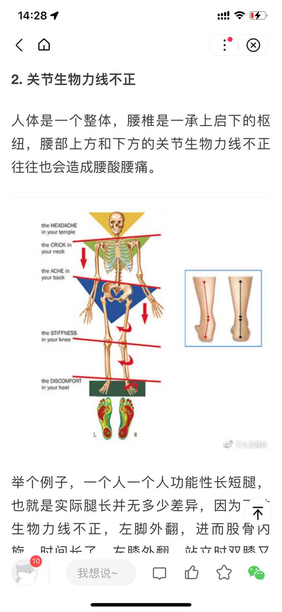 wanabetaller's tweet photo. The sequelae caused by the stupid rehabilitation suggestions of Turkish medically illiterate black agents and butchers really tortured me to the point of death every day! #brokenboneincrease##Avoid the Turkish black intermediary and increase your height step by step wanabetaller# https://t.co/m2JKiOOidi