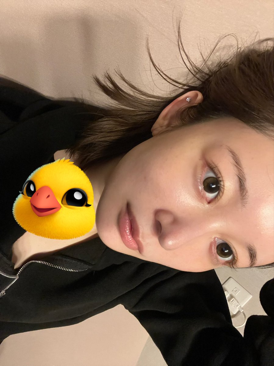 Tweely_3_'s tweet photo. 韓国でデュアルピーチリフト（計10本）、目の下の脂肪再配置、目の下と前頬の微細脂肪移植、ほうれい線フィラーしてきた❤️どっちもノーマルカメラで加工ゼロなんやけど、若返る😭
執刀医はイム院長！めっちゃ優しくて自分に合った施術メニュー組んでくれるよ！今年28歳まだまだいけます！ https://t.co/FqTtvLbcmO