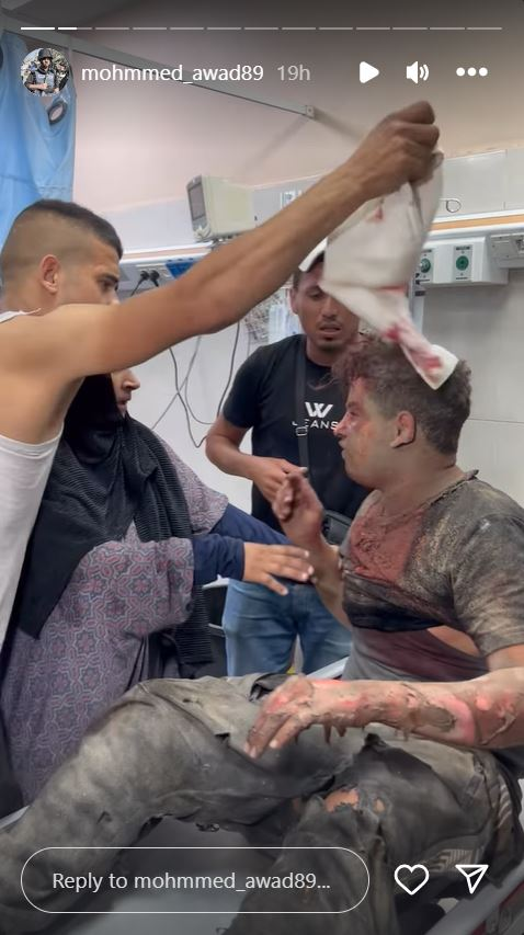 Thread: Israel-Hamas war misinformation - Day 38 This video's been viewed millions of times with claims it shows a hospitalised Palestinian man tell his mother he's faking injuries for cameras. The man isn't faking. The video was posted on Instagram by journalist Mohmmed Awad.