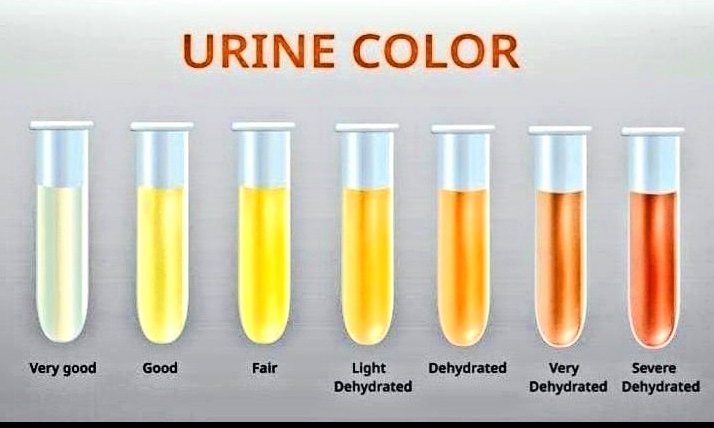 Urine Colour.