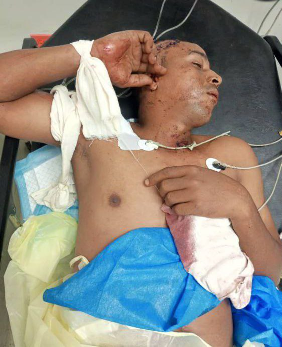 InforTvenezuela's tweet photo. Servicio Publico. 

Este ciudadano sufrió un accidente a las 4 de la mañana cerca de Turbisanj en Maca,Petare , se llama Yorman Rodriguez y está recluido en el Hospital Domingo Luciani ubicado en El Llanito,Caracas y no ha llegado ningún familiar lo cual el necesita con urgencia. https://t.co/vTXRRexhtc