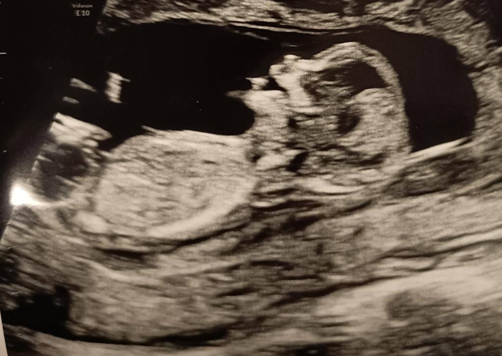 SelvesteGud tweet media