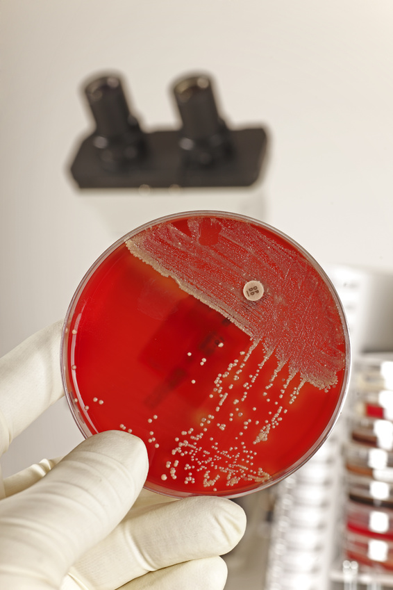 rki_de's tweet image. Molecular surveillance of daptomycin DAP-resistant #StaphylococcusAureus showed
🔵DAP-Resistance-Acquisition was linked to antiseptic rather than systemic antibiotic wound-treatment
🔵Resistance developed in all affected patients individually
@CMIJournal
➡️authors.elsevier.com/a/1hNEB,RGPgSB…