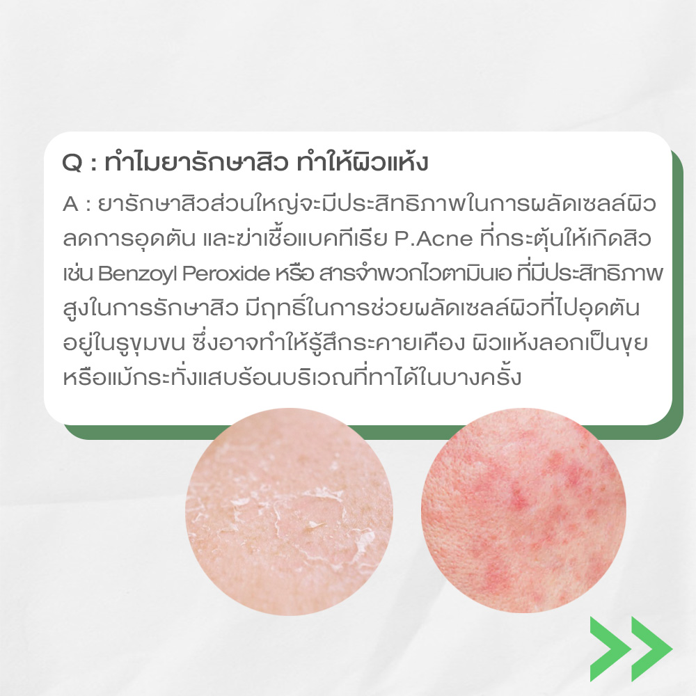 ibskincareth's tweet photo. https://t.co/iZxQtrbMFp