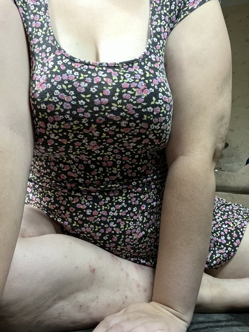 Sweet Sugar💋🍒♡ - @naomifuego420 @gaypunk44 @n0ty0uraveragee https://t.co/FeEDZ8WncV https://t.co/BZhSv3mond https://t.co/Vo4Qr4gptl