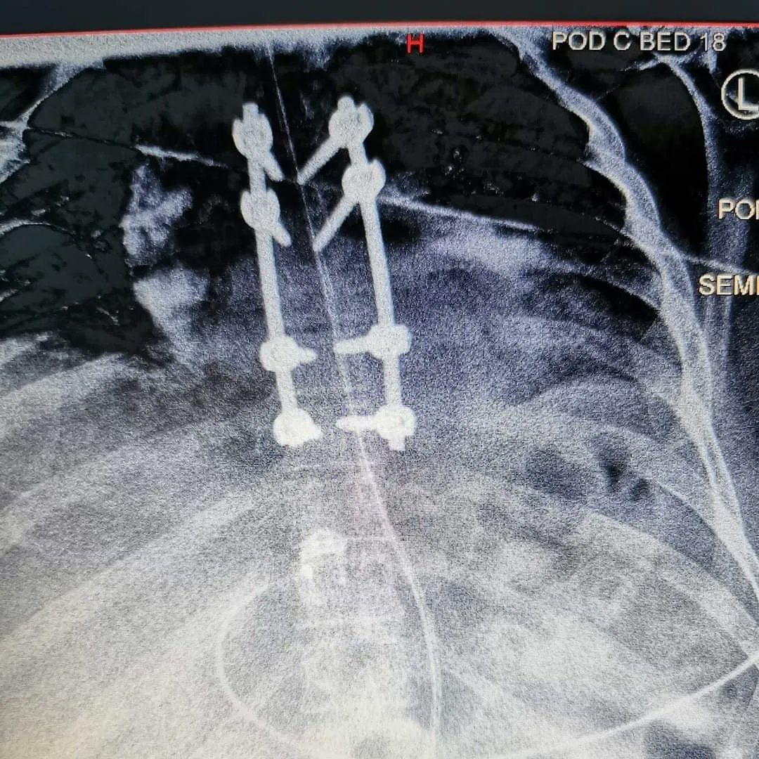 Paul Harvey tweet media