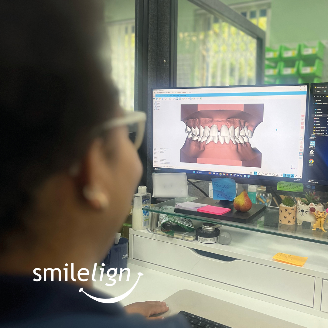 smilelign's tweet photo. Every plan is carefully mapped out for you!🤩 

Our skilled technicians plan out every single step of your treatment, resulting in your amazing new smile. Find out more about how Smilelign works here: https://t.co/ezaU8mciJ3 https://t.co/Ku6FFjRy8d