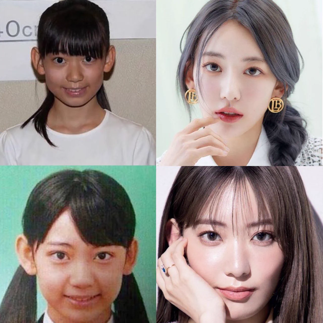 宮脇 咲 良 整形