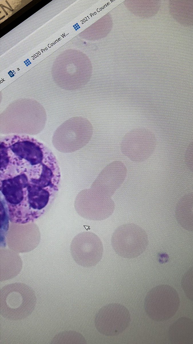 hellojsan's tweet image. Hoy nya samot kalabad ako ulo noh? HAHAHAHAHAHA