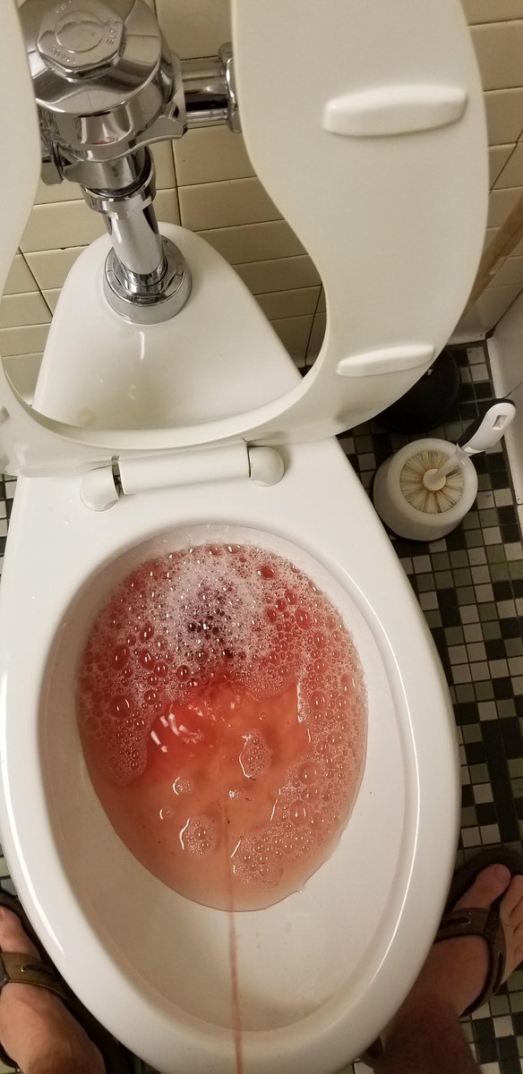 zac20611's tweet photo. damn i’m dehydrated today even though i drank 5 full water bottles https://t.co/SUhqNRnw1E