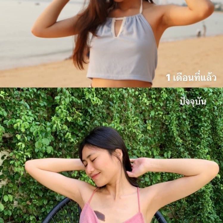 mOdeL76567073's tweet photo. อยากจะกรี๊ดด!!  1 เดือนที่แล้วคิดว่าจั๊กขาวเนียนมาตลอด พอได้ลองใช้เซตคู่หู Butter Sweet น้องจั๊กขาวเนียนขึ้นมาก จากจั๊กคล้ำๆในวันนั้น สู่จั๊กขาวเนียนในวันนี้อะแก มันเริ่ดด
#เซ็ทฟื้นฟูรักแร้คูณสอง #จั๊กคล้ำก็เนียนกริบ #สองคู่หูสุดปัง #saydewvy #buttersweet https://t.co/GHypsWjnki