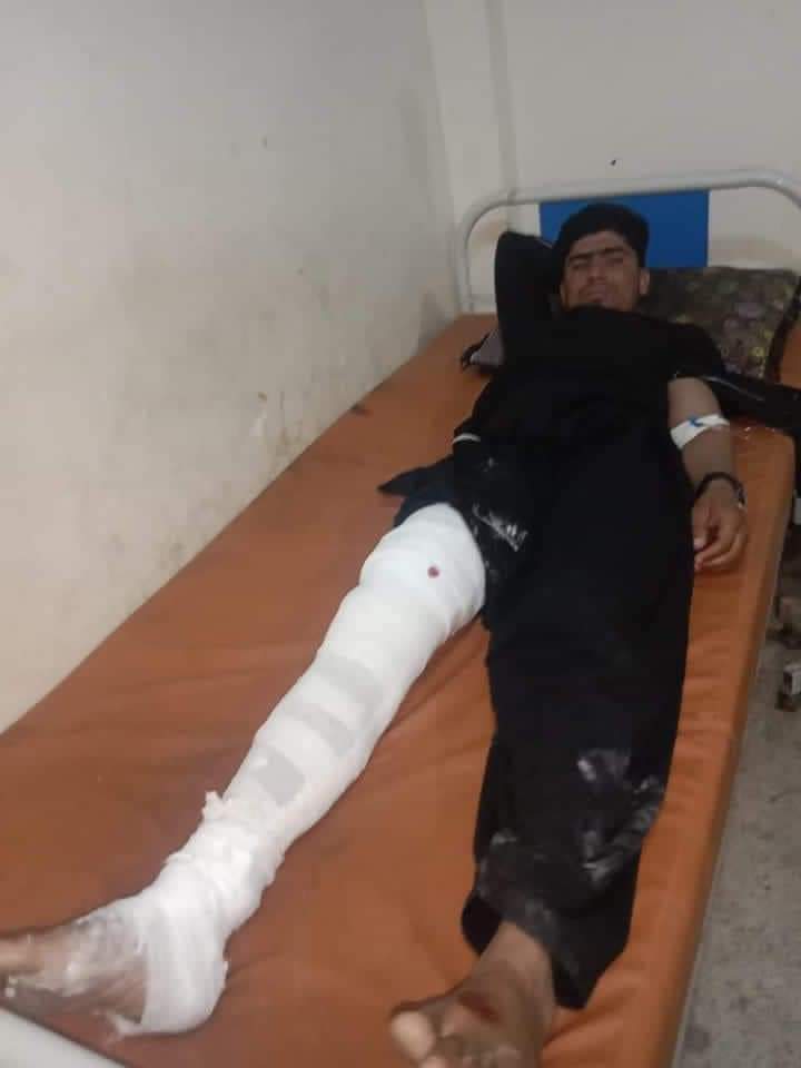 AabrooPashtana's tweet photo. At 3:00 p.m. in Zhob city, ongoing gunfire from the FC fort is causing mortar shells and other projectiles to rain down on civilians. Unfortunately, this has resulted in the death of a woman and serious injury to two children.
#ZhobUnderAttack #SaveZhob https://t.co/HvQL3peWZ4