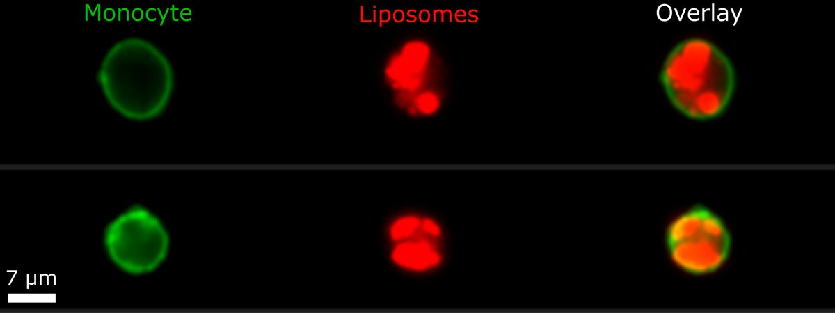 VIBLifeSciences's tweet image. 🔬 Great work in @NatureNano by @JokeDeprez from Dirk Elewaut&apos;s team and colleagues at @InflamResCen @ugent and @crighent that shows how liposomes are &apos;ferried&apos; to inflamed tissue by myeloid cells!
vibbio.tech/3NM8LLX