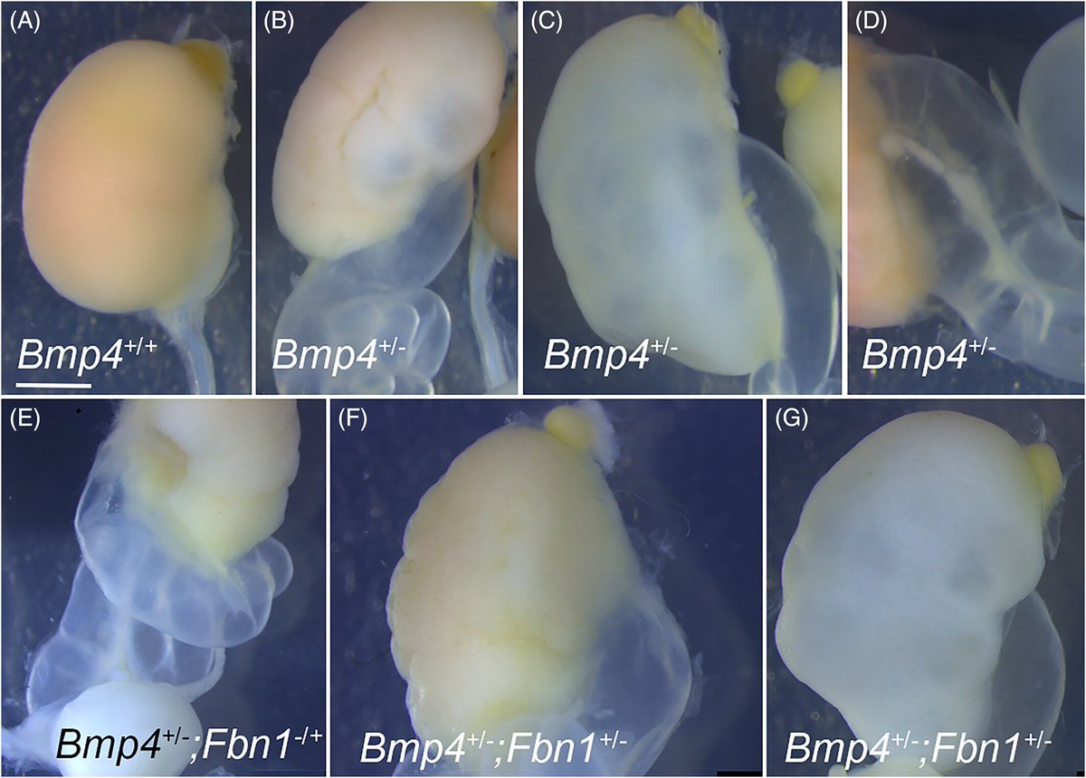 DevelopmentalDy's tweet photo. #BMP4 is required for #embryo development and adult homeostasis. Bmp4 and #Fbn1 are co-expressed and required for #lung development. This study uses genetic and biochemical analyses to explore FBN1 interactions with BMP4 during #organogenesis. https://t.co/94yQcpgRo0 https://t.co/Ux1jsAtR7c