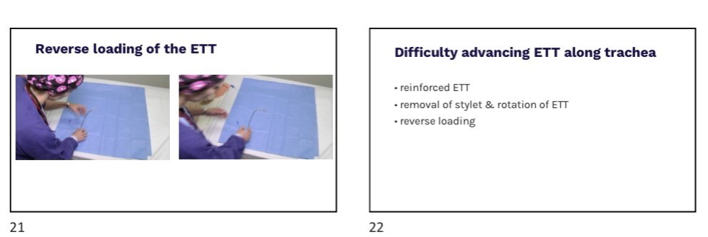 Dr Rani Chahal (@drranichahal) on Twitter photo <a href="/JonnyHarrison2/">Jonny Harrison</a> @dastrainees <a href="/dasairway/">Difficult Airway Society (DAS)</a> @UniversalAirway <a href="/VortexApproach/">The Vortex Approach</a> <a href="/ANZCA/">ANZCA</a> <a href="/AirwayMxAcademy/">Hans Huitink</a> <a href="/GongGasGirl/">Tanya</a> <a href="/drlauraduggan/">Dr. Laura Duggan</a> True Reverse loading the stylet is one of the commonly described ways. The others being 180 degree rotation of the ETT with the stylet out or using a reinforced ETT. This is just a technique that’s not commonly described. <a href="/JonnyHarrison2/">Jonny Harrison</a> @dastrainees <a href="/dasairway/">Difficult Airway Society (DAS)</a> @UniversalAirway <a href="/VortexApproach/">The Vortex Approach</a> <a href="/ANZCA/">ANZCA</a> <a href="/AirwayMxAcademy/">Hans Huitink</a> <a href="/GongGasGirl/">Tanya</a> <a href="/drlauraduggan/">Dr. Laura Duggan</a> True Reverse loading the stylet is one of the commonly described ways. The others being 180 degree rotation of the ETT with the stylet out or using a reinforced ETT. This is just a technique that’s not commonly described.