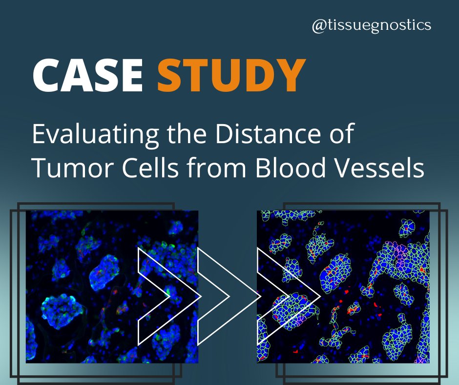TissueGnostics tweet media