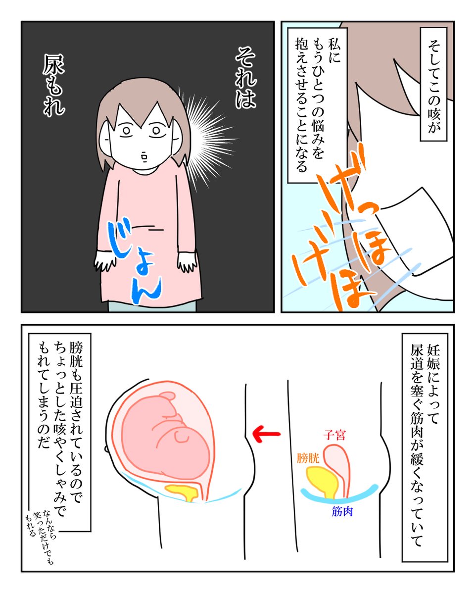 妊婦はもれなく尿もれに悩む 2/5 
