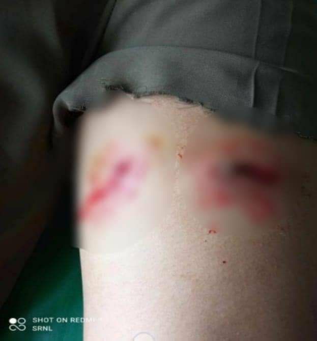 MaybomeM's tweet photo. Tw // wound  SAC armed forces shelled artilleries in KutKai tsp, Shan state yesterday, resulting in injuring of 3 local residents, according to TNLA.  #WhatsHappeningInMyanmar #2023Jul12Coup #WarCrimesOfJunta https://t.co/qAay99vA6R