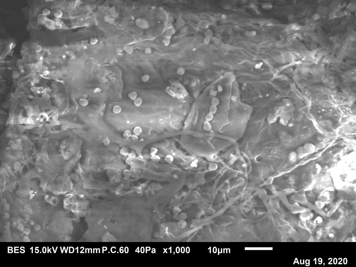 velsanang's tweet photo. Some interesting pictures on how #dairy processing #waste look from very close. 
@etnREFLOW https://t.co/vclHrvxtoU