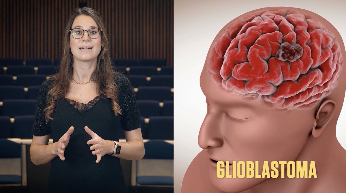 SciMingo's tweet photo. People with #brain #cancer #glioblastoma have on average only 15 months to live. "This terrible statistic shows that we urgently need new treatment options," says @MampayMrth @VUBrussel

She investigates the use of stem cells to fight glioblastoma

🎥 https://t.co/A3orsgPd2H https://t.co/giWedebstg