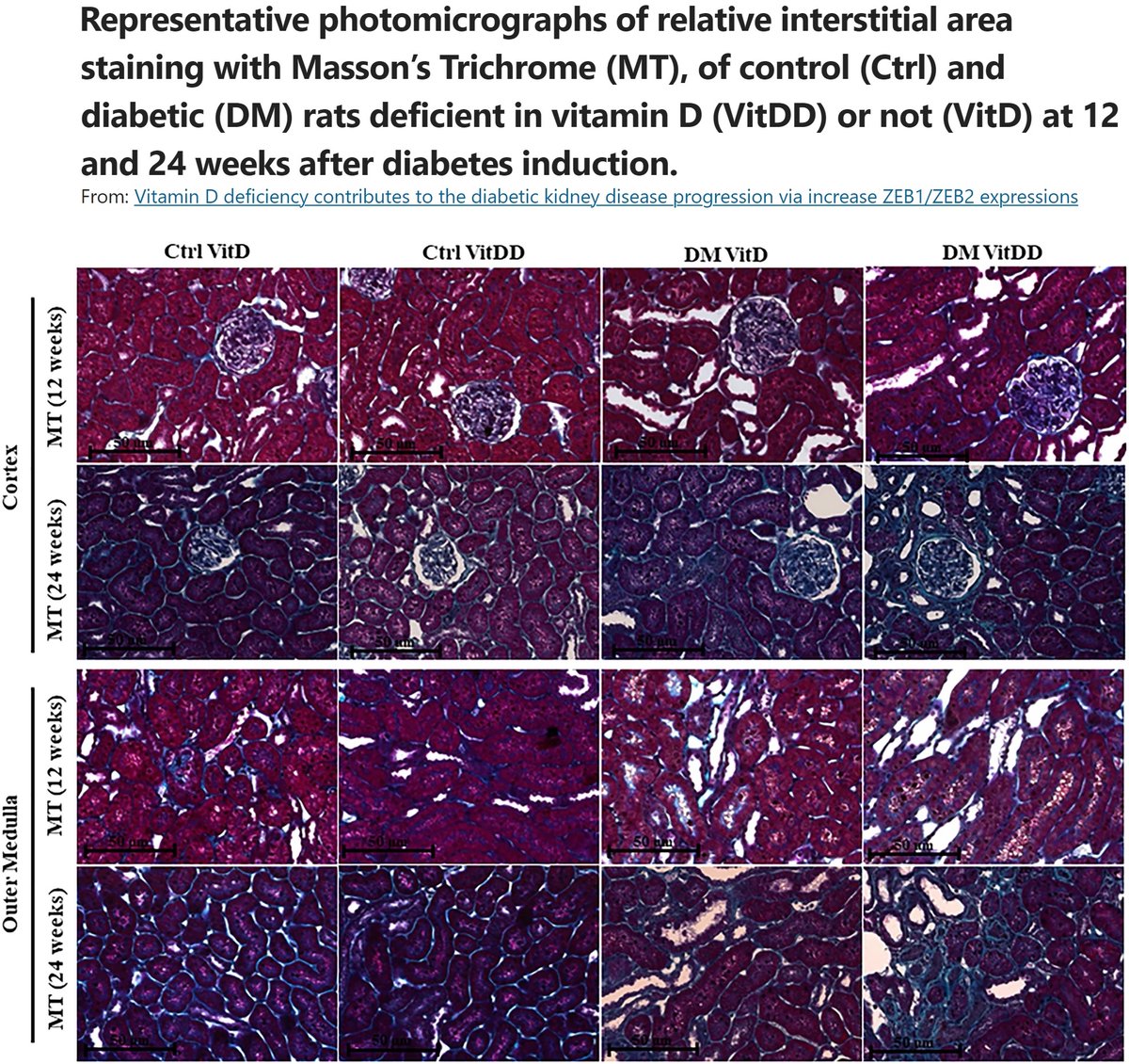 Nutrition & Diabetes tweet media