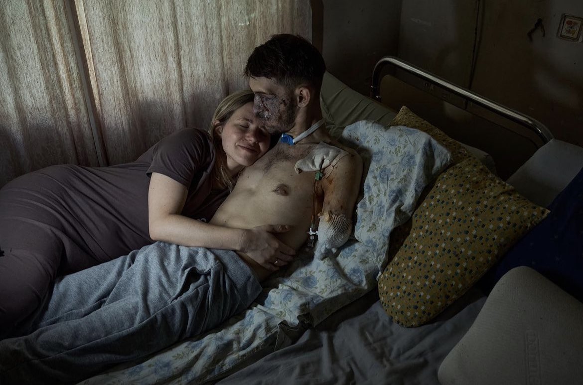IuliiaMendel's tweet photo. One couple. One love. Andriy loved to sing in chorus and to travel. He volunteered to defend Ukraine. He hardly stayed alive in the battle: he lost both hands and eyes and partially hearing. But he has not lost his love. His wife spends with him all the time helping to adapt and live farther. “This is how my world looks like now,” she wrote in her Instagram. If you want to help, her Instagram is @alina_smolenska photos: @Liberov