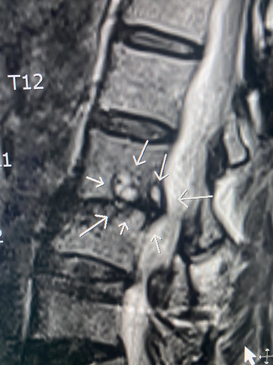 P Van Geertruyden MD FACR tweet media