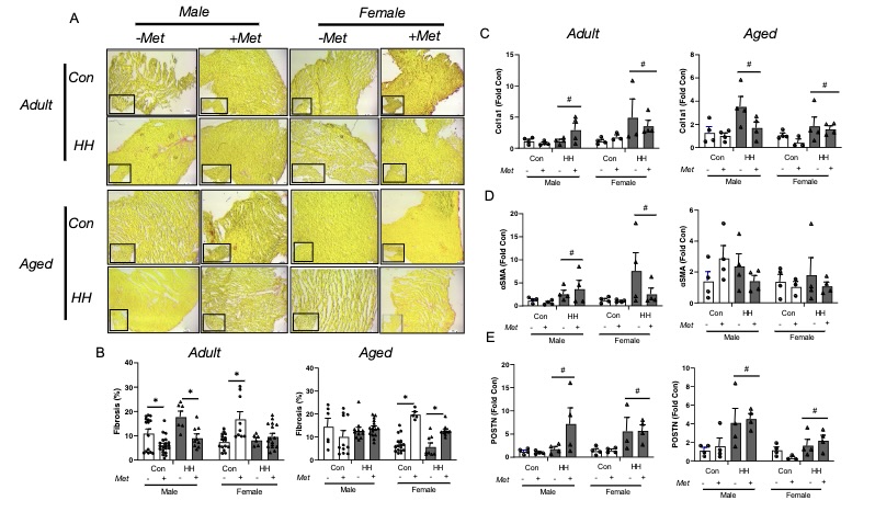 ajpheartcirc's tweet image. #ArticlesInPress: Metformin protects against #pulmonary hypertension-induced right #ventricular dysfunction in an age- and sex-specific manner independent of cardiac #AMPK
(McNair et al.)
ow.ly/1lya50P9qWQ

#rightventricle #aging #metformin