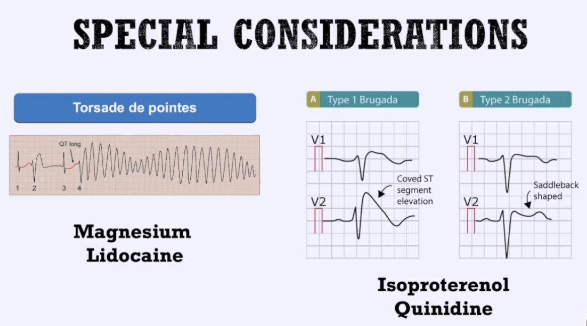 Glorilyn Joyce Ong, MD (@lynongmd) on Twitter photo Medications for Refractory VF #ResusXROSC <a href="/DanPatino7/">Daniel Patino, MD</a> <a href="/CriticalCareNow/">Haney Mallemat</a>
Torsade
💉MgSO4 or Lidocaine
Brugada = increased vagal tone
💉Isoproterenol or Quinidine to get rid of ST abnormality in ant leads & prevent recurrence of arrhythmias Medications for Refractory VF #ResusXROSC <a href="/DanPatino7/">Daniel Patino, MD</a> <a href="/CriticalCareNow/">Haney Mallemat</a>
Torsade
💉MgSO4 or Lidocaine
Brugada = increased vagal tone
💉Isoproterenol or Quinidine to get rid of ST abnormality in ant leads & prevent recurrence of arrhythmias