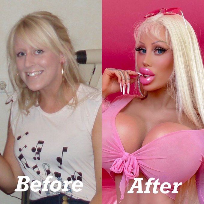 From natural girl to custom made plastic Bimbo ?

https://t.co/CT9Je8KP0J https://t.co/GLJ30e56TW