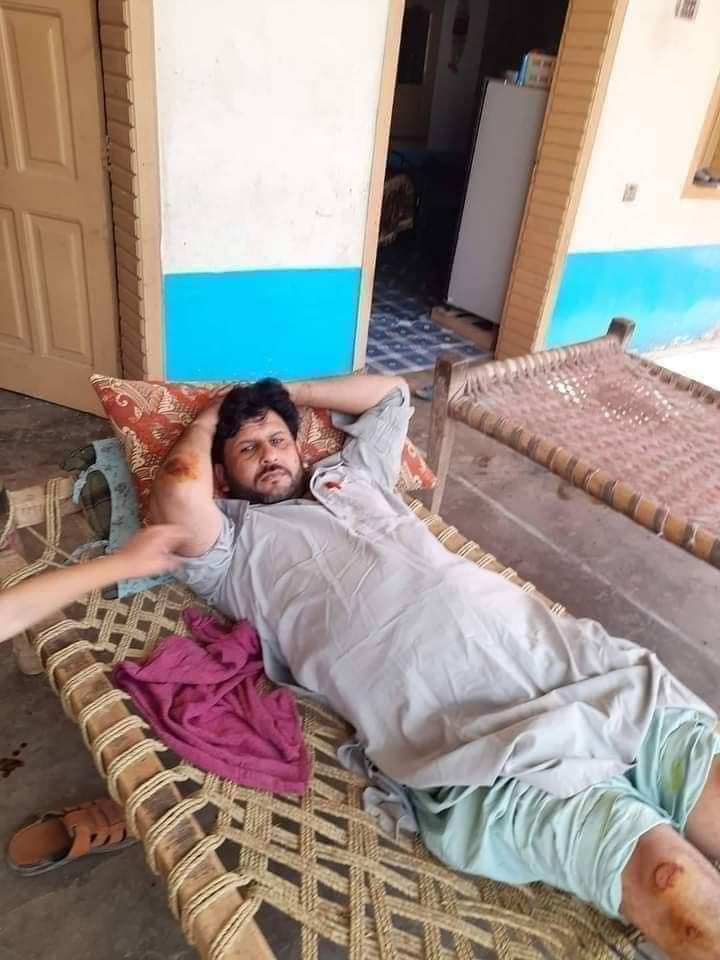 ctplahore's tweet photo. جو حال اس ہیلمٹ کا ہوا اس سے کئی گنا زیادہ برا حال اس بھائی کے سر کا ہونا تھا اور شائد اب تک اس کے معصوم بچوں کی زندگیاں تباہ ہو چکی ہوتیں مگر شکر الحمدللہ اس بھائی نے ہیلمٹ پہن ��کھا تھا اور اللہ تعالیٰ نے اس کو محفوظ رکھا معمولی زخموں کے بعد اب یہ اپنے بچوں کے  ساتھ ہے ❤️ https://t.co/DhnChYQv6I