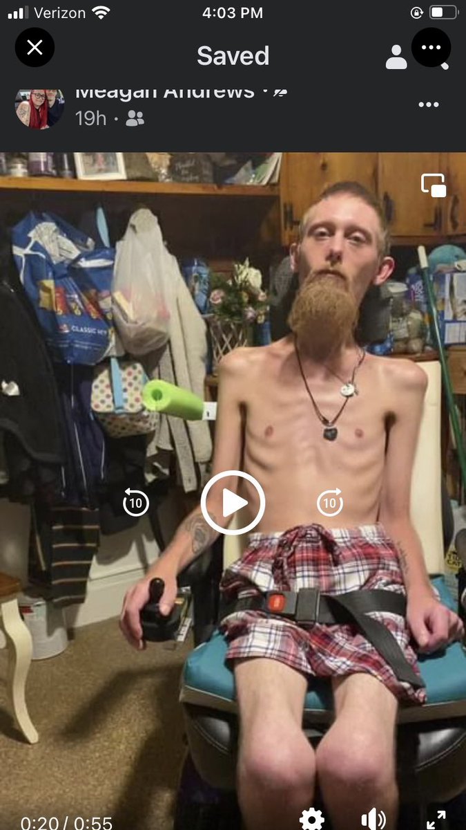 No Mother or Father would ever want to watch this happen to your child. We have lost more than most. I can guarantee the lose of your child is like no other   😞😞. We would have taken any chance 1% or 30 % to save him ALS needs treatments now no matter what percentage.vsDeath