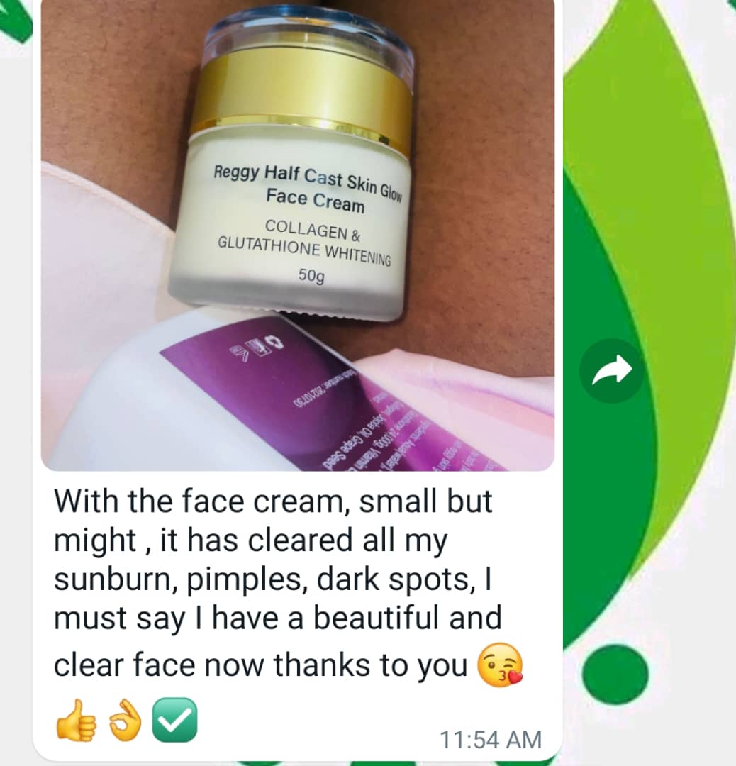 RTruevine's tweet photo. Transform your skin with ReggySkincare! We're thrilled to share this glowing review from one of our happy customers: 'With ReggySkincare's Half Cast Skin Glow Face Cream, my sunburn, pimples, and dark spots are history! 😍 Now, I'm rocking a beautiful and clear face!' 
#yvonne https://t.co/CadBZ8h13m