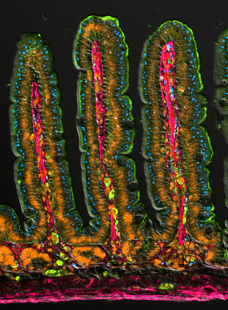 I love some nicely sectioned villi

#MicroscopyMonday #bioart #sciart #histoart #pathart #underthemicroscope #intestine #Microscopy